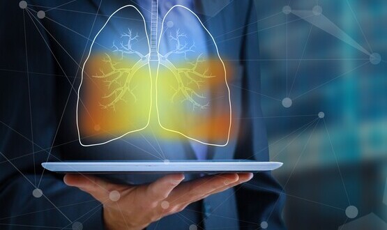 InHealth partners with Qure.ai for AI-powered chest x-ray solution