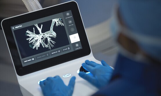 St Bartholomew’s perform first robotic-assisted lung biopsy
